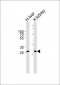 ECHDC3 Antibody (N-term)